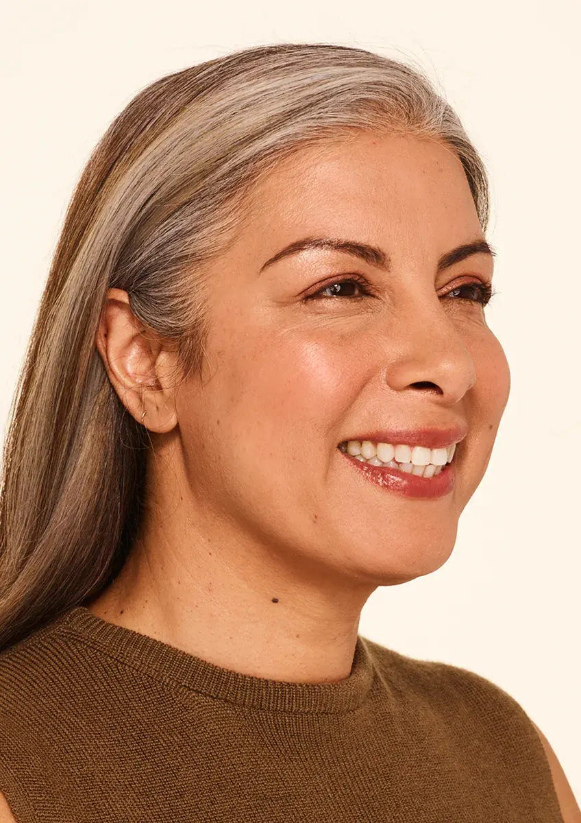 After Wrinkle Relaxers TOX