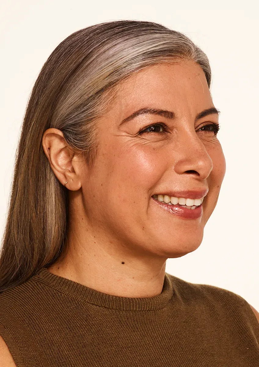 Before Wrinkle Relaxers TOX