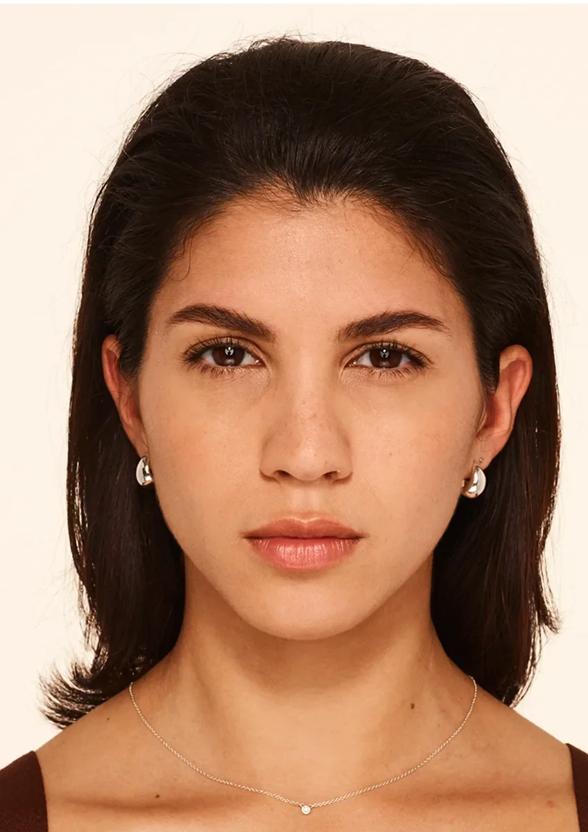 After Wrinkle Relaxers TOX
