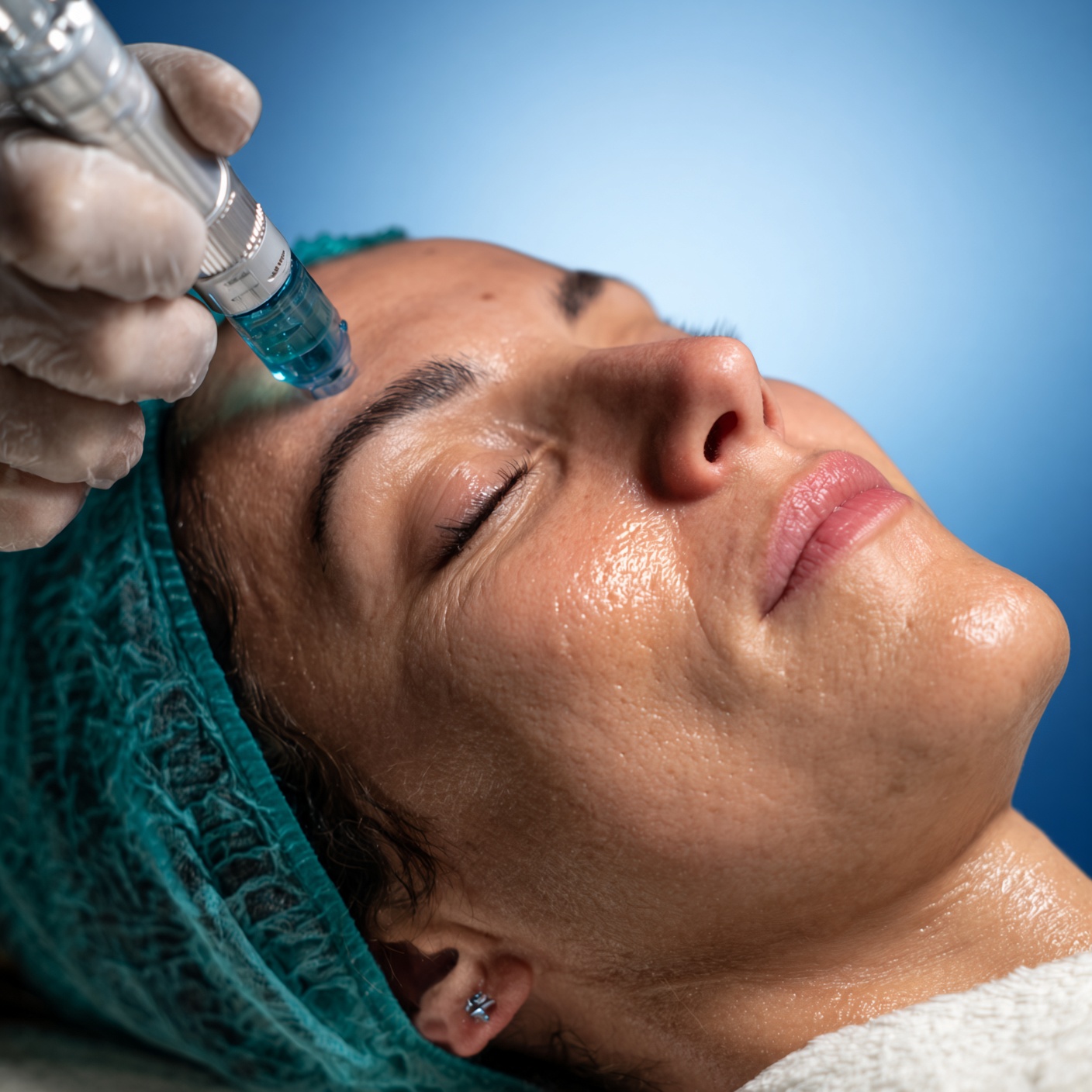 HydraFacial