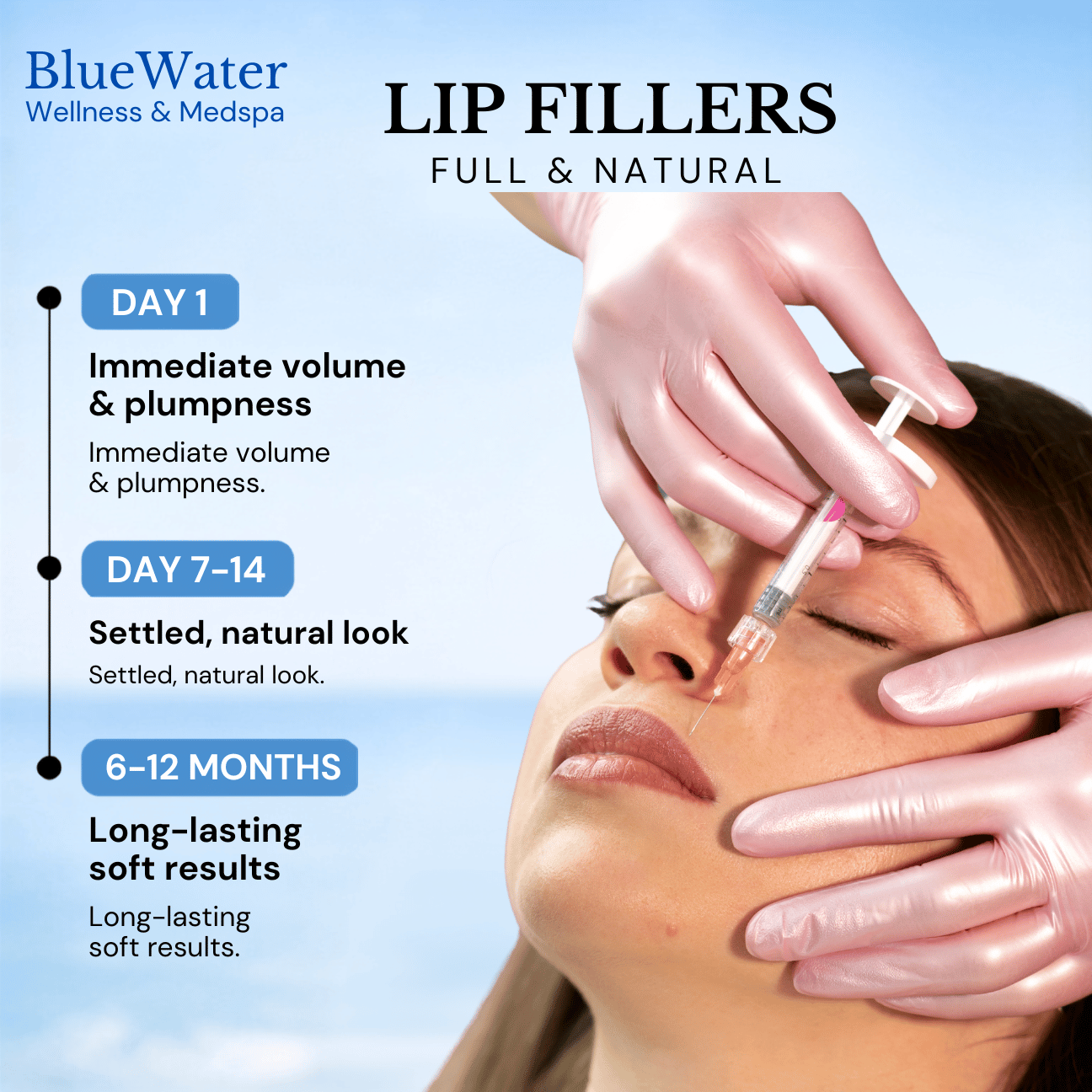 Lip Filler at BlueWater Wellness in Ponte Vedra, FL